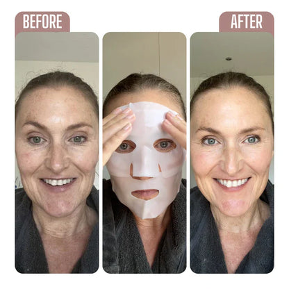 VitaHex™ - Bio-Collagen Masks 4x